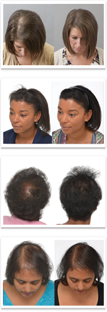 Women Before and After